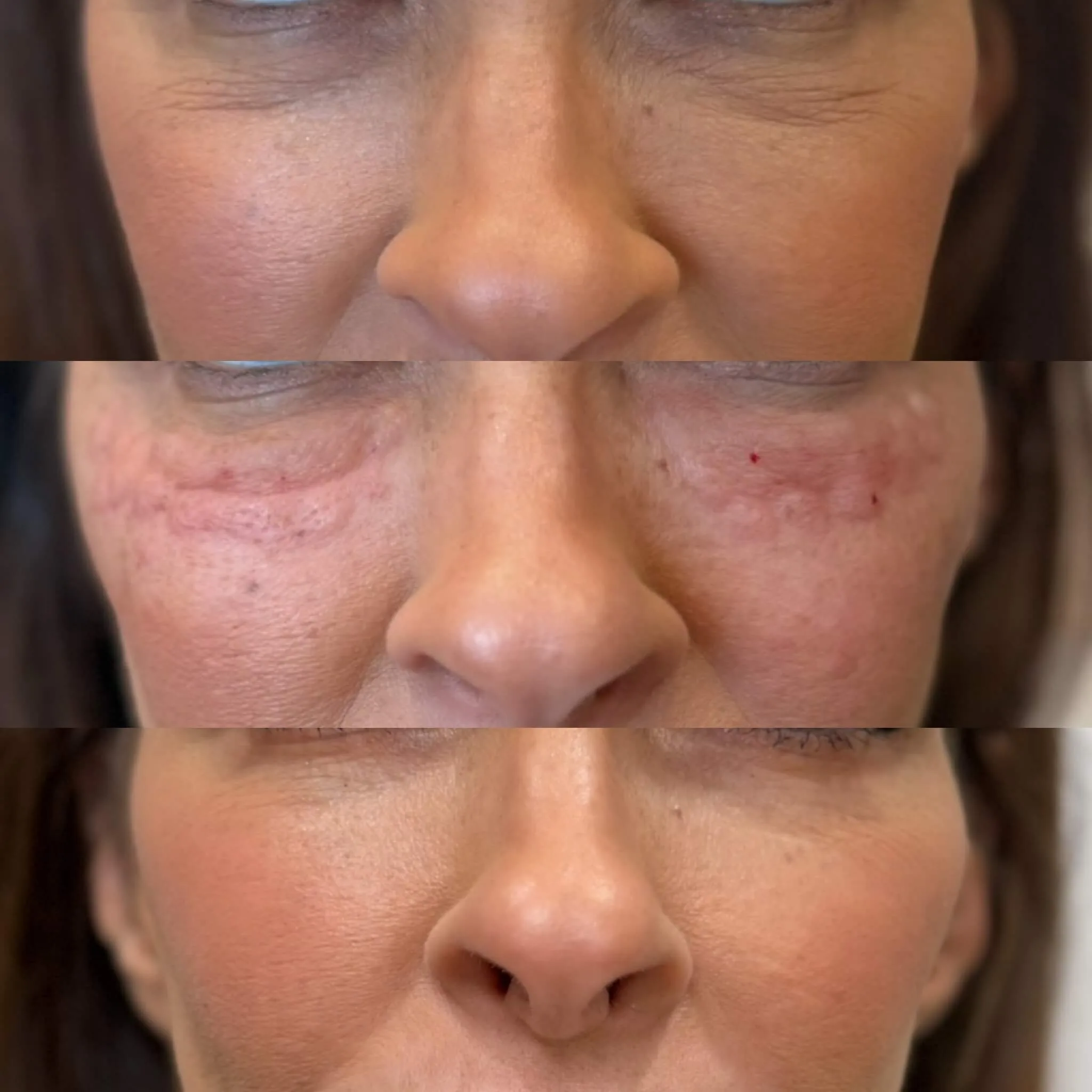 Skin treatment results
