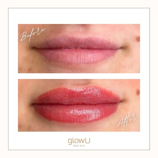 Lip blushing transformation before and after at glowU Med Spa in Boca Raton, FL