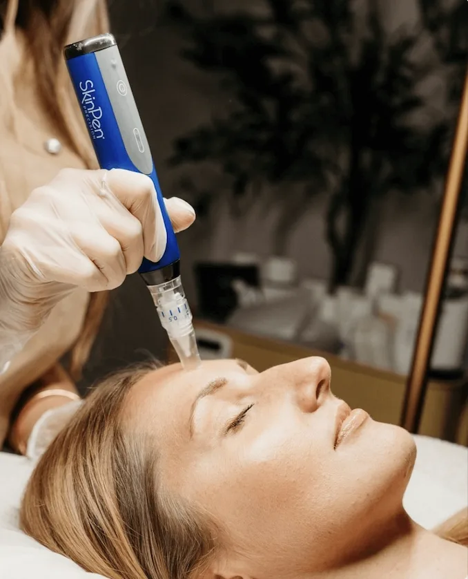 Microneedling
